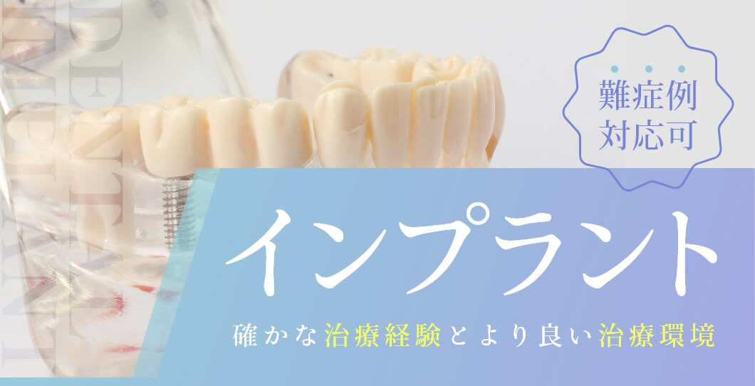インプラント